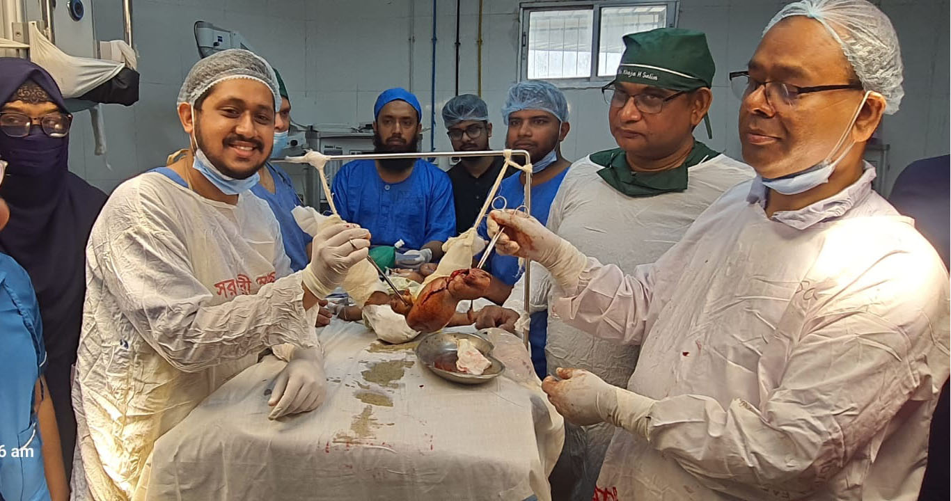 গাজীপুরে এক শিশুর ভিতর আরেক শিশুর অস্তিত্ব, অস্ত্রোপচারে চিকিৎসকদের সফলতা